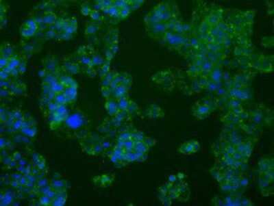Immunocytochemistry/ Immunofluorescence: PFKFB4 Antibody (OTI1C8) [NBP2-02226]