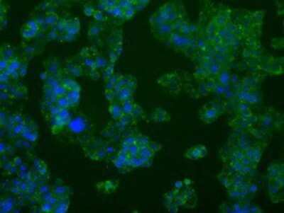 Immunocytochemistry/ Immunofluorescence: PFKFB4 Antibody (OTI1C8) - Azide and BSA Free [NBP2-73340]