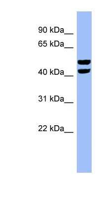 Western Blot: PFKFB4 Antibody [NBP1-57620]