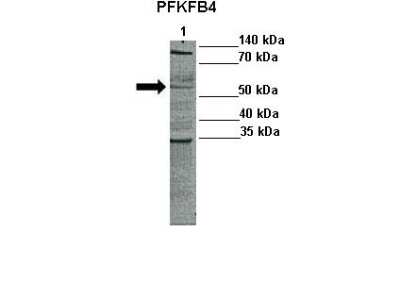 Western Blot: PFKFB4 Antibody [NBP1-57620]
