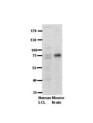 Western Blot: PFKL Antibody [NBP1-56607]