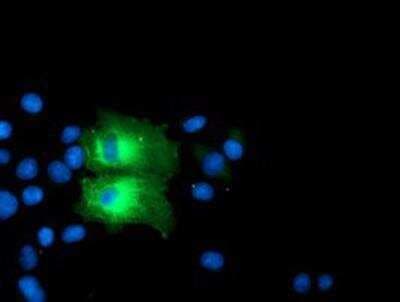 Immunocytochemistry/ Immunofluorescence: PFKP Antibody (OTI1D6) [NBP2-01539]