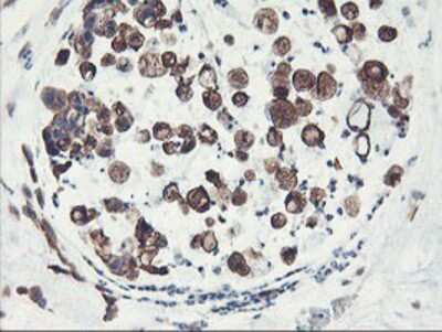 Immunohistochemistry-Paraffin: PFKP Antibody (OTI1D6) [NBP2-01539]