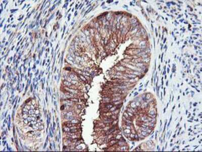 Immunohistochemistry-Paraffin: PFKP Antibody (OTI1D6) [NBP2-01539]