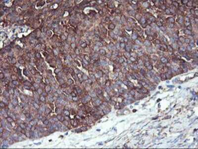 Immunohistochemistry-Paraffin: PFKP Antibody (OTI1D6) [NBP2-01539]