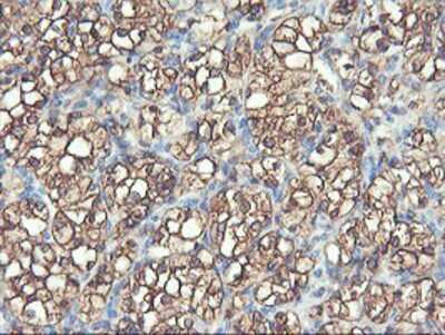 Immunohistochemistry-Paraffin: PFKP Antibody (OTI1D6) [NBP2-01539]