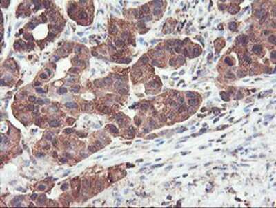 Immunohistochemistry-Paraffin: PFKP Antibody (OTI1D6) [NBP2-01539]
