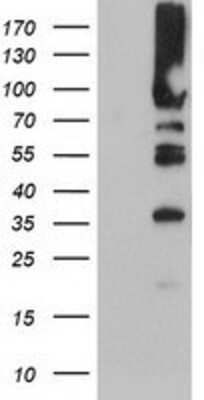 Western Blot: PFKP Antibody (OTI1D6) [NBP2-01539]