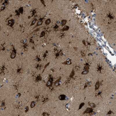 Immunohistochemistry-Paraffin: PFKP Antibody [NBP1-92256]