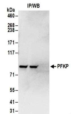 Immunoprecipitation: PFKP Antibody [NBP2-32083]