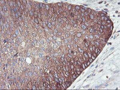Immunohistochemistry: PFKP Antibody (OTI1D6) - Azide and BSA Free [NBP2-73344]