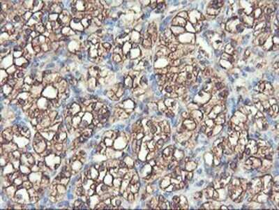 Immunohistochemistry: PFKP Antibody (OTI1D6) - Azide and BSA Free [NBP2-73344]