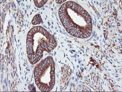 Immunohistochemistry: PFKP Antibody (OTI1D6) - Azide and BSA Free [NBP2-73344]