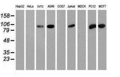 Western Blot: PFKP Antibody (OTI1D6)Azide and BSA Free [NBP2-73344]