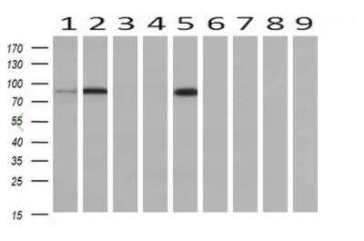 Western Blot: PFKP Antibody (OTI1D6) [NBP2-01539]