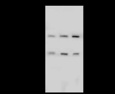 Western Blot: PFKP Antibody [NBP2-99101]