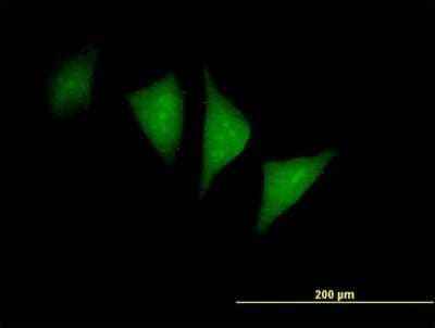 Immunocytochemistry/ Immunofluorescence: PFTK1 Antibody [H00005218-B01P]