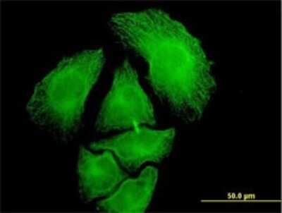 Immunocytochemistry/ Immunofluorescence: PGA5 Antibody (4G9) [H00005222-M02]