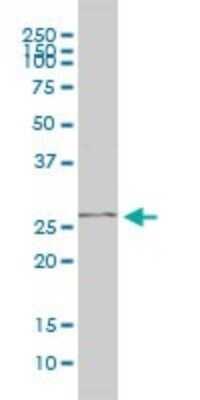 Western Blot: PGAM1 Antibody (2G1-A6) [H00005223-M01]