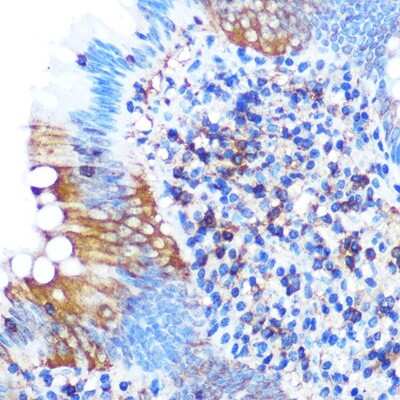 Immunohistochemistry-Paraffin: PGAM1 Antibody (7V9H9) [NBP3-16347]