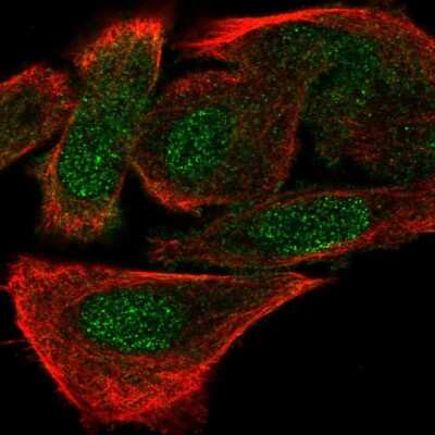 Immunocytochemistry/ Immunofluorescence: PGAM1 Antibody [NBP2-46676]