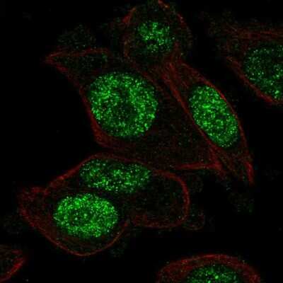 Immunocytochemistry/ Immunofluorescence: PGAM1 Antibody [NBP2-56569]