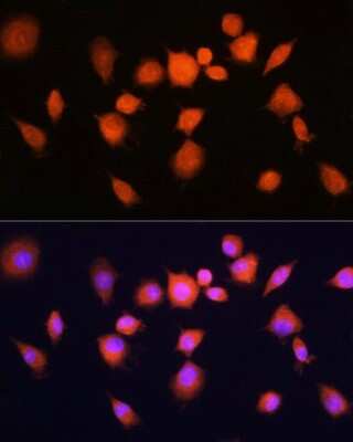 Immunocytochemistry/ Immunofluorescence: PGAM1 Antibody - BSA Free [NBP2-95109]