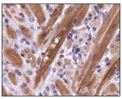 Immunohistochemistry: PGAM1 Antibody - BSA Free [NBP1-49532]
