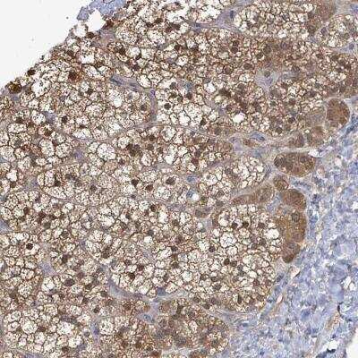 Immunohistochemistry-Paraffin: PGAM1 Antibody [NBP2-46676]