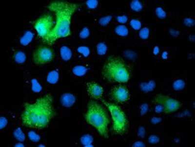 Immunocytochemistry/ Immunofluorescence: PGAM2 Antibody (OTI4E9) [NBP2-01142]