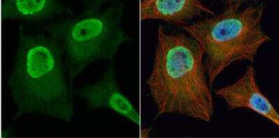 Immunocytochemistry/ Immunofluorescence: PGAM2 Antibody [NBP1-32966]