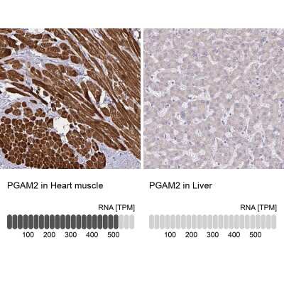 Immunohistochemistry-Paraffin: PGAM2 Antibody [NBP2-38889]