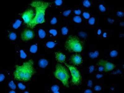 Immunocytochemistry/ Immunofluorescence: PGAM2 Antibody (OTI4E9) - Azide and BSA Free [NBP2-73358]