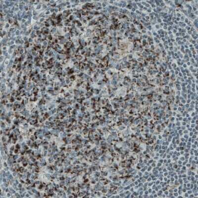 Immunohistochemistry-Paraffin: PGAM5 Antibody (CL0624) [NBP2-52947]