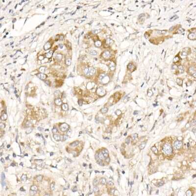 Immunohistochemistry-Paraffin: PGAM5 Antibody - Azide and BSA Free [NBP2-93600]