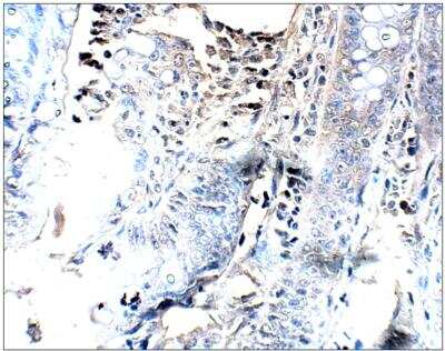 Immunohistochemistry: PGAP3 Antibody [NBP3-12195]
