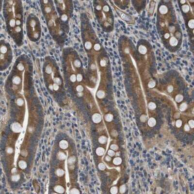 Immunohistochemistry-Paraffin: PGAP3 Antibody [NBP1-86692]