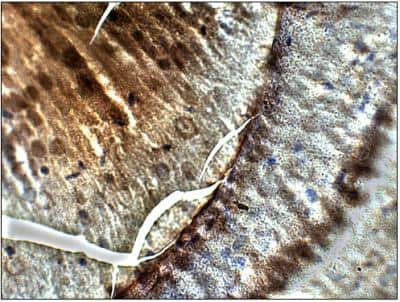 Immunohistochemistry-Paraffin: PGAP3 Antibody [NBP3-12196]