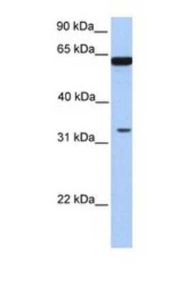 Western Blot: PGAP3 Antibody [NBP1-69334]