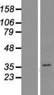Western Blot: PGAP3 Overexpression Lysate [NBP2-05879]