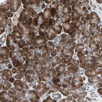 Immunohistochemistry-Paraffin: PGBD1 Antibody [NBP1-85162]