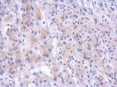 Immunohistochemistry-Paraffin: PGBD1 Antibody [NBP2-19782]