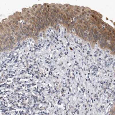 Immunohistochemistry-Paraffin: PGBD2 Antibody [NBP1-85936]