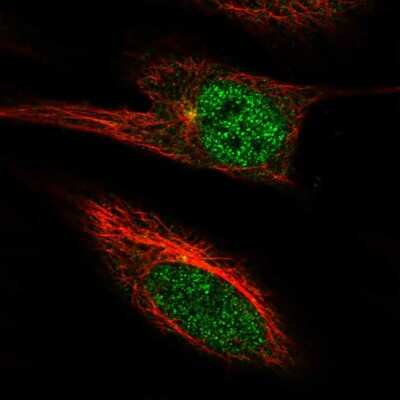 Immunocytochemistry/ Immunofluorescence: PGBD4 Antibody [NBP2-56747]
