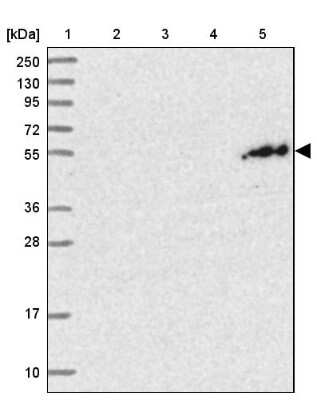 Western Blot: PGBD4 Antibody [NBP1-81995]