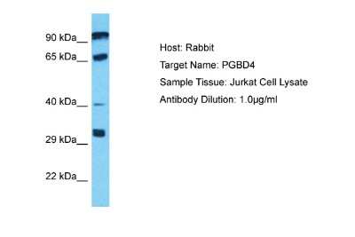 Western Blot: PGBD4 Antibody [NBP2-85466]