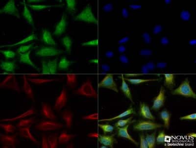 Immunocytochemistry/Immunofluorescence Staining of PGC1 alpha in HeLa Cells