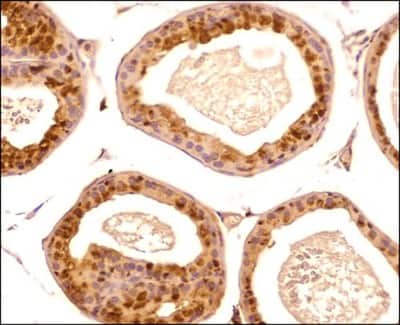 Immunohistological Staining of PGC1 alpha in Paraffin Embedded Mouse Prostate