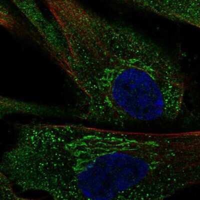 Immunocytochemistry/ Immunofluorescence: PGCP Antibody [NBP1-87457]