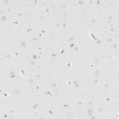 Immunohistochemistry-Paraffin: PGCP Antibody [NBP1-87545]